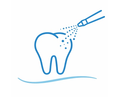 Medizinische Entfernung von Zahnverfärbungen